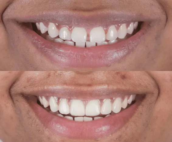 Oral health screenings