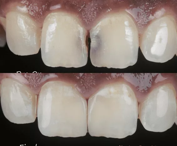 Dental check-ups and cleanings