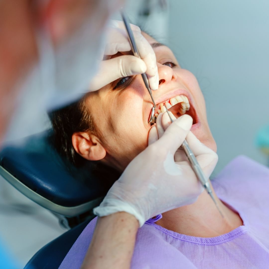 Jaw surgery (orthognathic surgery)