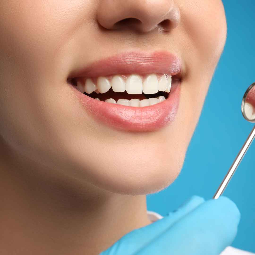 Cosmetic and aesthetic dentistry at Delhi Dental Cosmetics