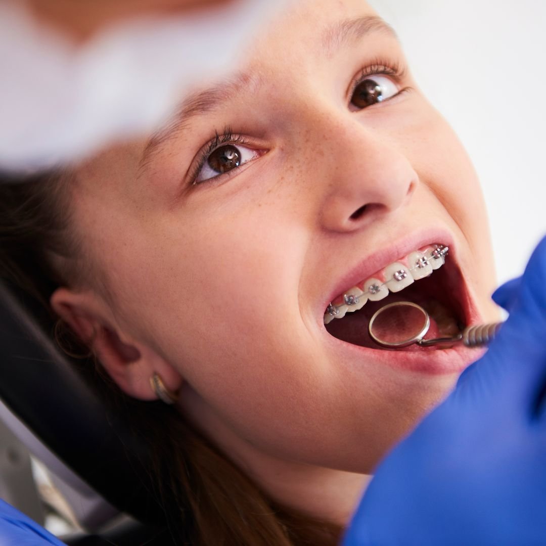 Pedodontics — dentistry for children at Delhi Dental Cosmetics
