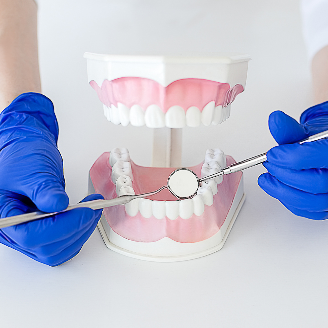 Composite bonding