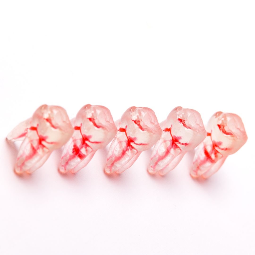 Root canal therapy