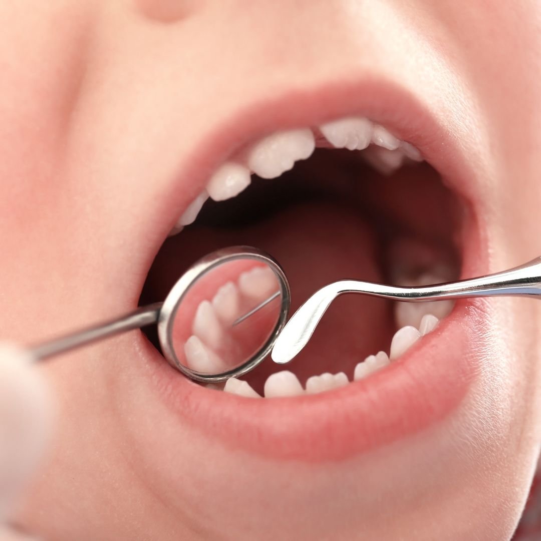 Early orthodontic assessment
