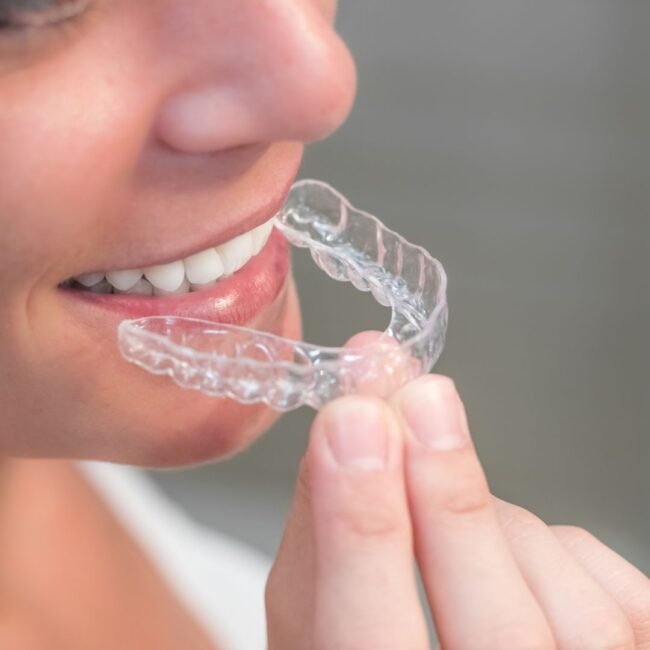 Orthodontic treatment at Delhi Dental Cosmetics