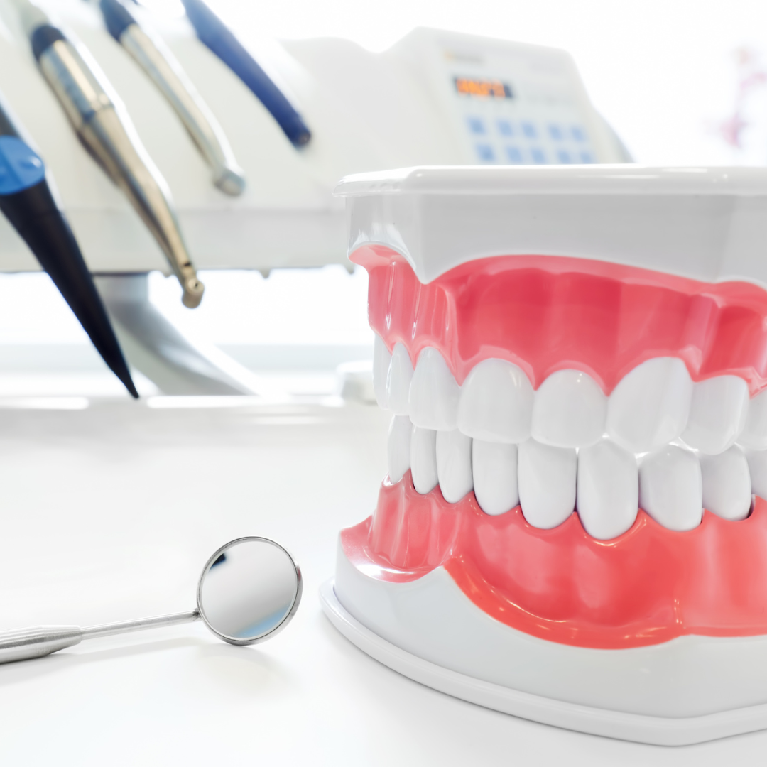 Dental veneers