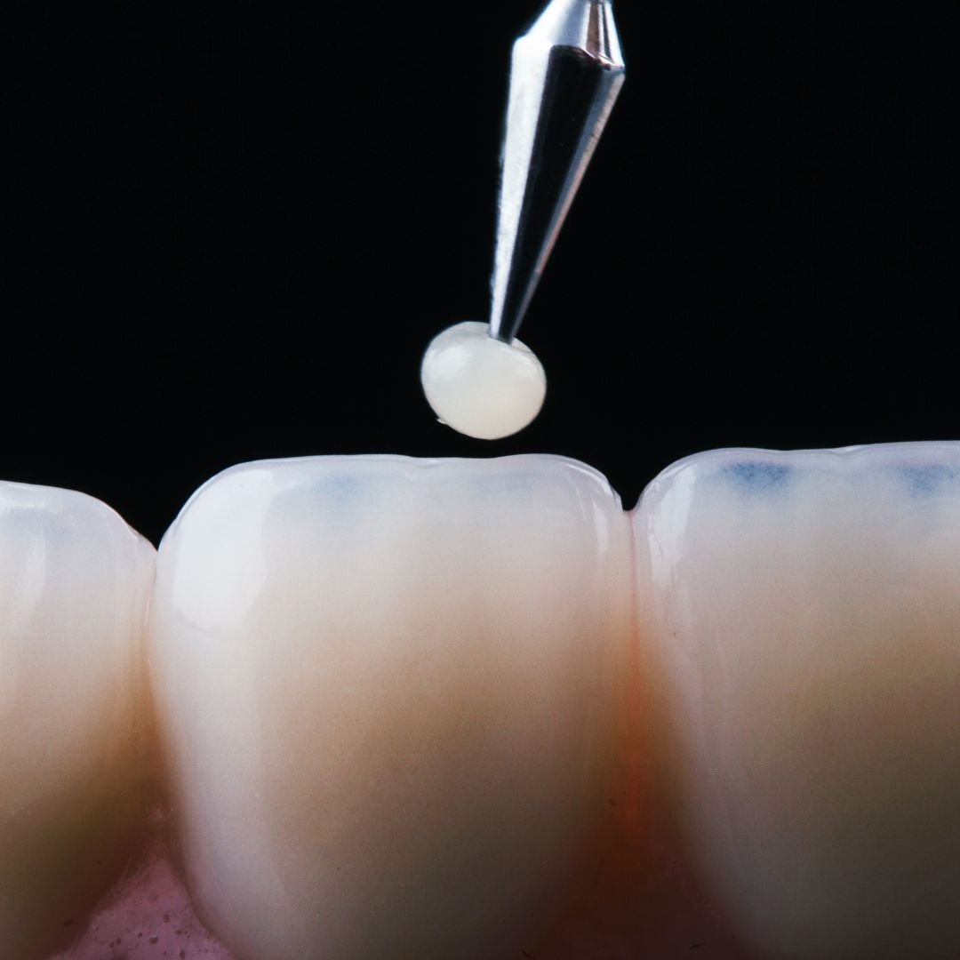 Dental crowns