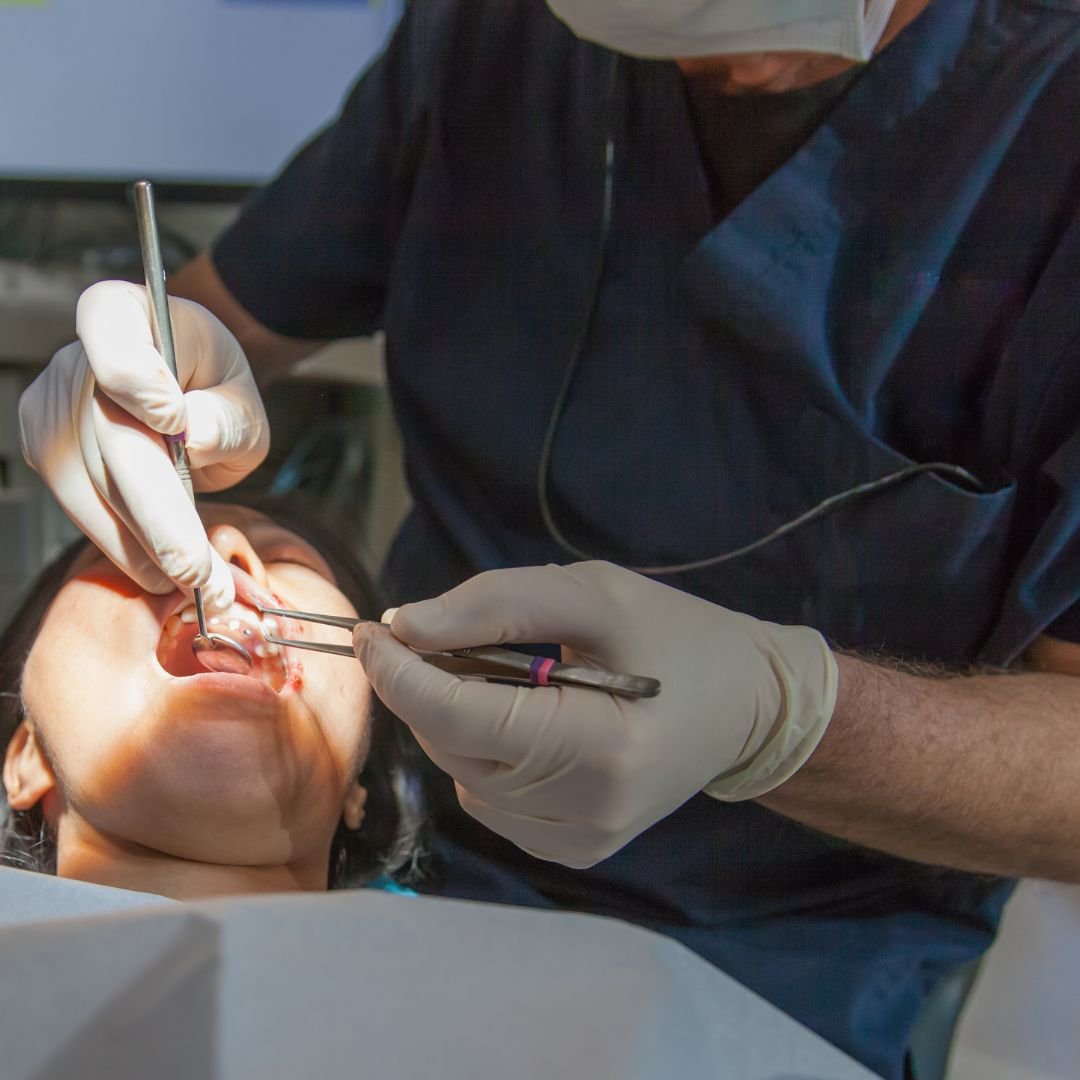 Wisdom tooth extraction