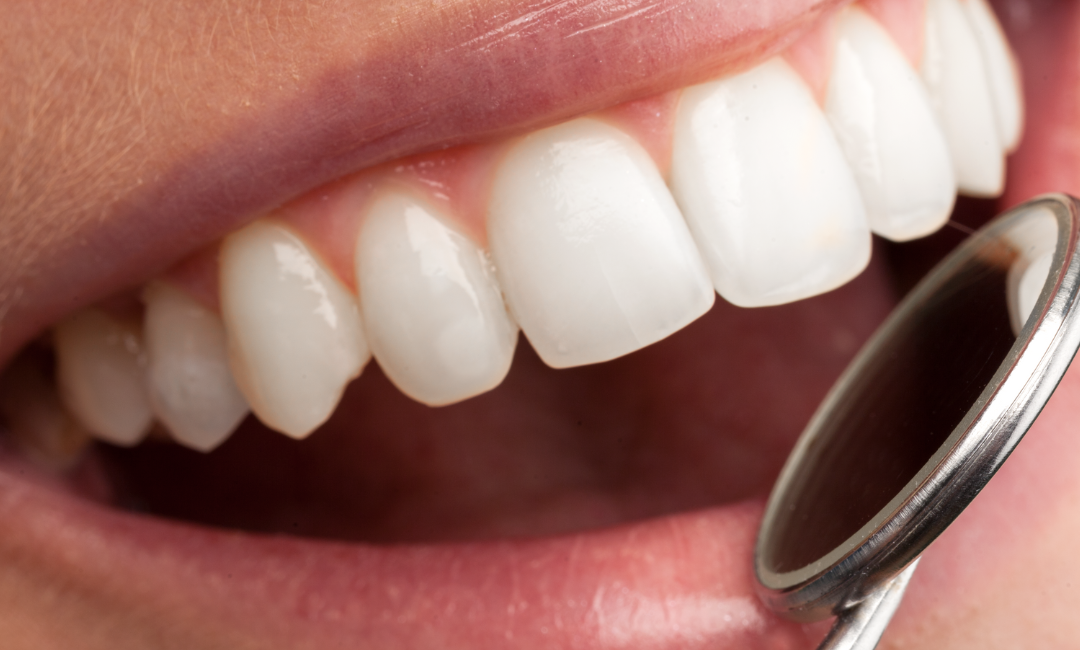 General dentistry at Delhi Dental Cosmetics