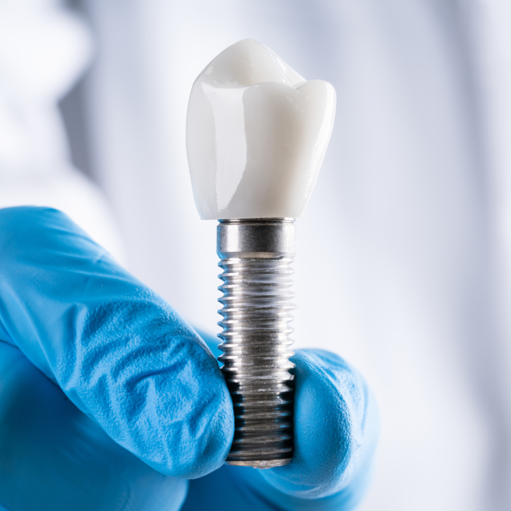 Dental implants at Delhi Dental Cosmetics